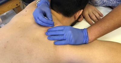 Is Dry Needling an Effective Treatment for Carpal Tunnel?Excel Sports PT